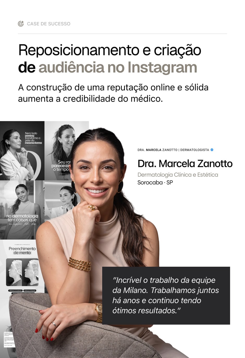Case de sucesso da Dra. Marcela Zanotto, dermatologista