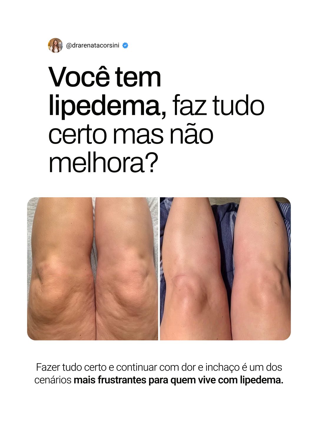 Post de Dra. Renata Corsini